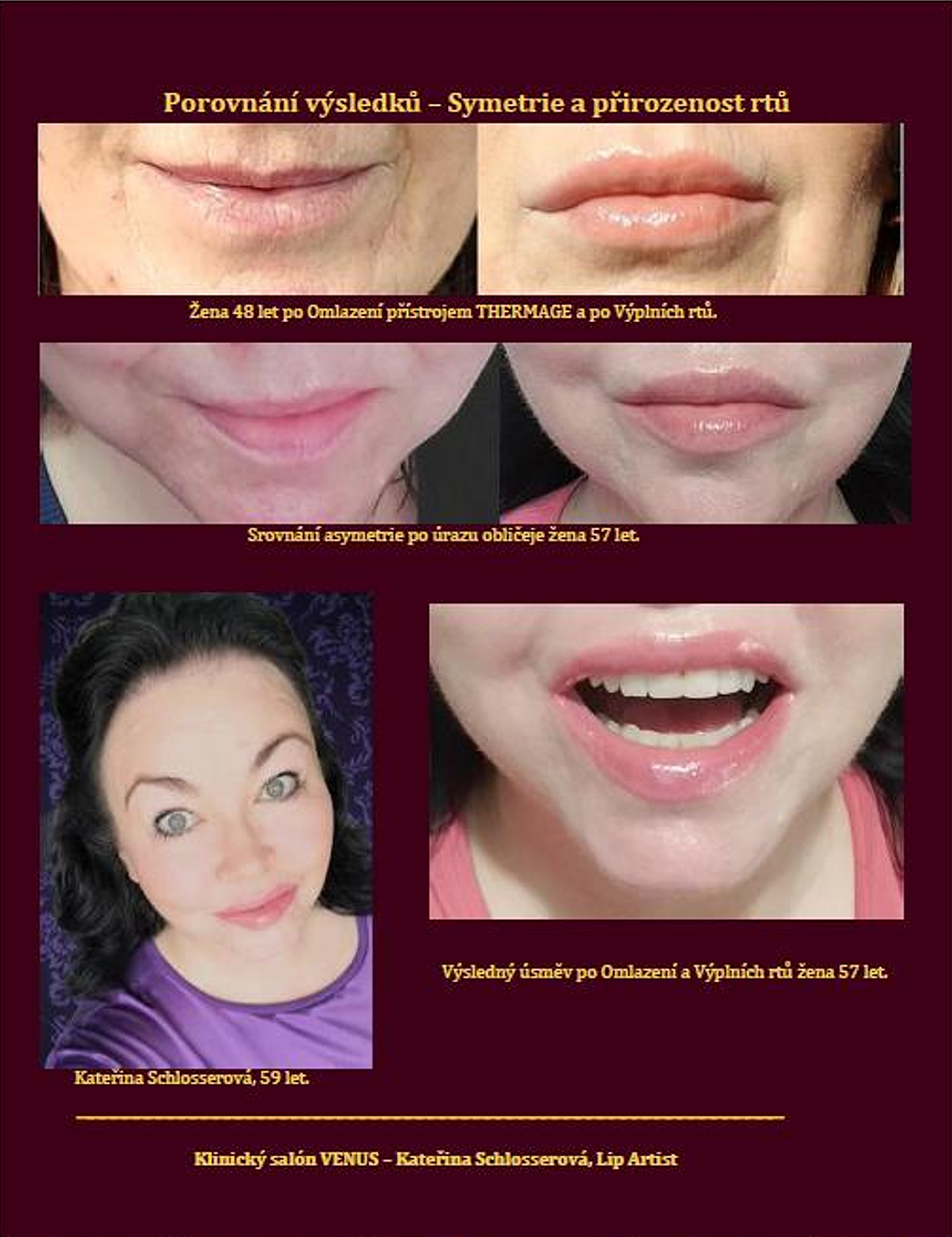 obrázek POROVNÁNÍ RTŮ NA.jpg